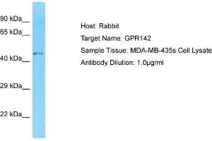 Host: Rabbit Target Name: GPR142 Sample Type: MDA-MB-435s Whole Cell lysates Antibody Dilution: 1.