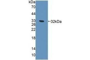 Detection of Recombinant EXO1, Human using Polyclonal Antibody to Exonuclease 1 (EXO1) (Exonuclease 1 Antikörper  (AA 1-250))