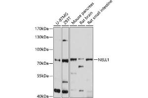 Western blot analysis of extracts of various cell lines, using NELL1 antibody (ABIN6132410, ABIN6144530, ABIN6144531 and ABIN6214585) at 1:1000 dilution. (NELL1 Antikörper  (AA 160-420))