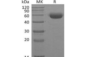 Western Blotting (WB) image for Interleukin 22 (IL22) protein (mFc Tag) (ABIN7320587) (IL-22 Protein (mFc Tag))
