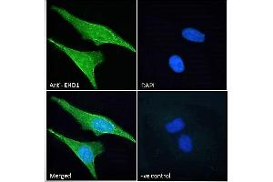 ABIN7013871 Immunofluorescence analysis of paraformaldehyde fixed HeLa cells, permeabilized with 0. (EHD1 Antikörper  (N-Term))
