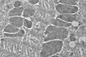 Immunoelectron microscopy analysis of LR white resin-embedded mouse heart using HSP60 (ABIN7074167) at dilution of 1: 50. (HSPD1 Antikörper)