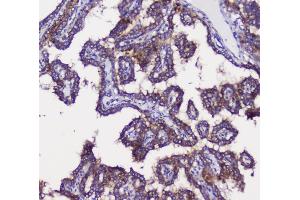 IHC analysis of GRIK1 using anti-GRIK1 antibody (ABIN3042430).