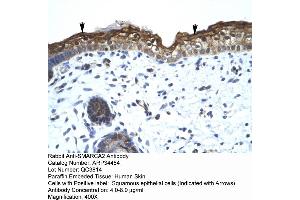 Immunohistochemistry (IHC) image for anti-SWI/SNF Related, Matrix Associated, Actin Dependent Regulator of Chromatin, Subfamily A, Member 2 (SMARCA2) (Middle Region) antibody (ABIN2775822)