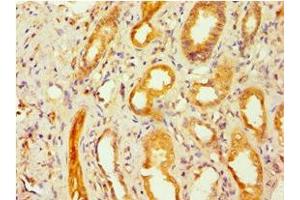 Immunohistochemistry of paraffin-embedded human kidney tissue using ABIN7153663 at dilution of 1:100 (Non-Syndromic Hearing Impairment Protein 5 (GSDME) (AA 1-260) Antikörper)