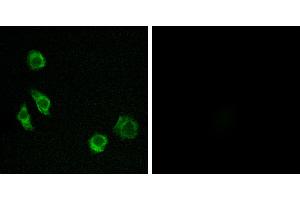 Peptide - +Western blot analysis of extracts from Jurkat cells, using GPRC5D antibody. (GPRC5D Antikörper  (Internal Region))