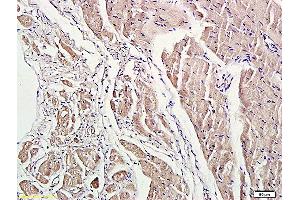 Immunohistochemistry (IHC) image for anti-rho-Associated, Coiled-Coil Containing Protein Kinase 1 (ROCK1) (AA 1001-1200) antibody (ABIN738636)