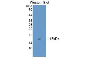 Detection of Recombinant CBY1, Human using Polyclonal Antibody to Chibby Homolog 1 (CBY1) (CBY1/PGEA1 Antikörper  (AA 12-115))