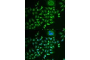 Immunofluorescence analysis of MCF-7 cells using SCG2 antibody (ABIN5973825). (SCG2 Antikörper)