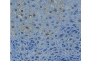 IHC-P analysis of liver tissue, with DAB staining. (NR1H2 Antikörper  (AA 1-446))
