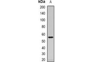 Western blot analysis of Dopamine Receptor D5 expression in mouse brain (A) whole cell lysates. (DRD5 Antikörper)