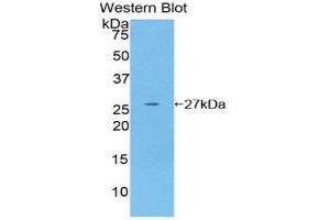 Western Blotting (WB) image for anti-Glutathione S-Transferase mu 4 (GSTM4) (AA 18-215) antibody (ABIN1859095)