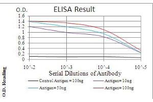 Black line: Control Antigen (100 ng), Purple line: Antigen(10 ng), Blue line: Antigen (50 ng), Red line: Antigen (100 ng), (TERT Antikörper  (AA 1029-1132))