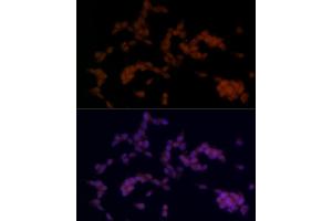 Immunofluorescence analysis of SH-SY5Y cells using SOX11 Rabbit pAb (ABIN7270569) at dilution of 1:100 (40x lens). (SOX11 Antikörper)