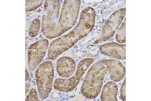 Immunohistochemistry (IHC) image for anti-Fructose-1,6-Bisphosphatase 1 (FBP1) antibody (ABIN7267269)