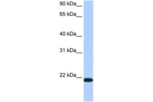 Western Blotting (WB) image for anti-Transmembrane Emp24 Protein Transport Domain Containing 4 (TMED4) antibody (ABIN2462360) (TMED4 Antikörper)