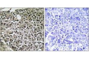 Immunohistochemistry (IHC) image for anti-Nuclear Factor of Activated T-Cells, Cytoplasmic, Calcineurin-Dependent 4 (NFATC4) (AA 642-691) antibody (ABIN1532367)