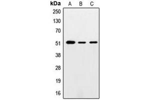 Western blot analysis of SMAD5 expression in HeLa (A), mouse testis (B), PC12 (C) whole cell lysates. (SMAD5 Antikörper  (Center))