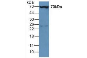 Figure. (Plastin 3 Antikörper  (AA 5-251))