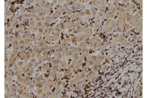 ABIN6273388 at 1/100 staining Human liver tissue by IHC-P. (RIOK2 Antikörper  (Internal Region))