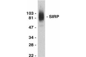Western blot analysis of SIRP alpha in THP-1 whole cell lysate with this product at 0. (SIRPA Antikörper  (C-Term))