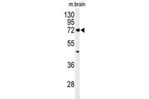 Western blot analysis of ABCD2 Antibody (Center) in mouse brain tissue lysates (35 µg/lane). (Abcd2 Antikörper  (Middle Region))