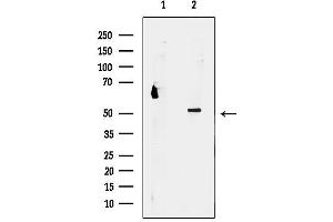 Western blot analysis of lysates from HepG2 cells, using PSM Antibody.