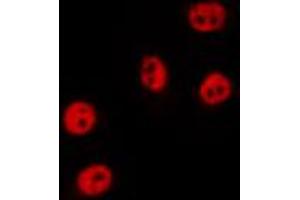 ABIN6274530 staining HepG2 by IF/ICC. (ZAK Antikörper  (N-Term))