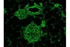 Image no. 3 for anti-Vimentin (VIM) antibody (ABIN335382) (Vimentin Antikörper)
