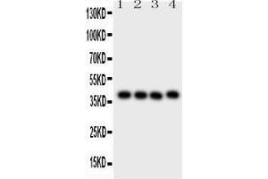 Western Blotting (WB) image for anti-CD34 (CD34) (AA 151-385) antibody (ABIN3043391) (CD34 Antikörper  (AA 151-385))