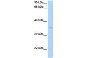 Image no. 1 for anti-Cyclin N-terminal Domain Containing 1 (CNTD1) (AA 201-250) antibody (ABIN6748274) (CNTD1 Antikörper  (AA 201-250))