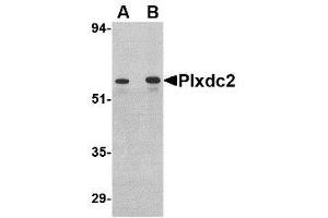 Image no. 1 for anti-Plexin Domain Containing 2 (PLXDC2) (C-Term) antibody (ABIN1492166) (PLXDC2 Antikörper  (C-Term))