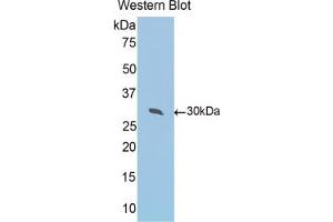 Western blot analysis of the recombinant protein. (Peroxiredoxin 4 Antikörper  (AA 14-258))