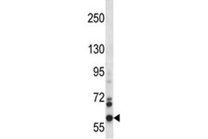 NOX5 antibody western blot analysis in CEM lysate. (NOX5 Antikörper  (AA 680-709))