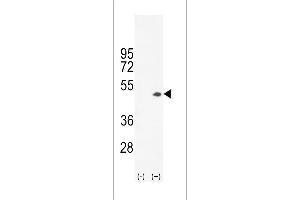 Western blot analysis of CKB (arrow) using rabbit polyclonal CKB- (ABIN391074 and ABIN2841221). (CKB Antikörper  (C-Term))