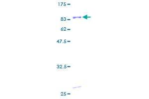 Image no. 1 for Protein Kinase, Interferon-Inducible Double Stranded RNA Dependent Activator (PRKRA) (AA 1-313) protein (GST tag) (ABIN1316302) (PRKRA Protein (AA 1-313) (GST tag))