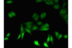 Immunofluorescent analysis of HepG2 cells using ABIN7164982 at dilution of 1:100 and Alexa Fluor 488-congugated AffiniPure Goat Anti-Rabbit IgG(H+L) (PSMB5 Antikörper  (AA 106-188))