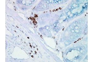 Immunohistochemistry analysis using Mouse Anti-Hsp70 Monoclonal Antibody, Clone BB70 . (HSP70/HSC70 Antikörper  (FITC))