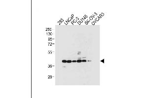 All lanes : Anti-STRA8 Antibody (C-term) at 1:2000 dilution Lane 1: 293 whole cell lysate Lane 2: LNCaP whole cell lysate Lane 3: PC-3 whole cell lysate Lane 4: D whole cell lysate Lane 5: SK-OV-3 whole cell lysate Lane 6: OVCAR3 whole cell lysate Lysates/proteins at 20 μg per lane.