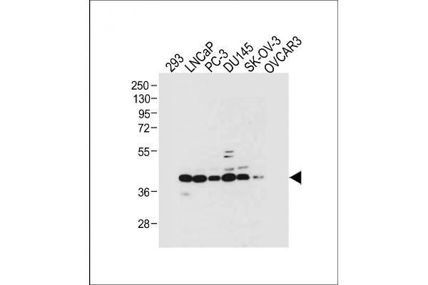 STRA8 anticorps  (C-Term)