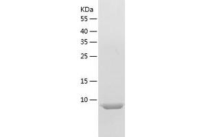 Western Blotting (WB) image for Defensin, beta 1 (DEFB1) (AA 33-69) protein (His tag) (ABIN7122619)