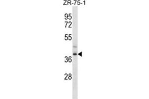 Western Blotting (WB) image for anti-Formyl Peptide Receptor 3 (FPR3) antibody (ABIN2997055) (FPR3 Antikörper)