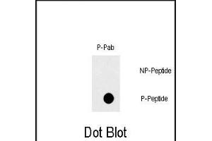 Dot blot analysis of Phospho-FAS- polyclonal antibody (ABIN389708 and ABIN2839663) on nitrocellulose membrane. (FAS Antikörper  (pTyr291))
