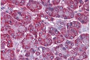 Human Pancreas: Formalin-Fixed, Paraffin-Embedded (FFPE) (SORBS1 Antikörper  (AA 300-313))
