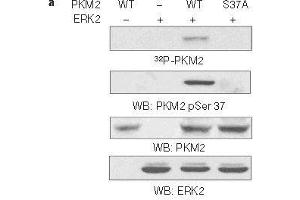 Western blot analysis of in vitro kinase assays carried out with puried active ERK2, wild-type (WT) PKM2 and PKM2 S37A mutant using PKM2(phospho-Ser37)Antibody. (PKM Antikörper  (pSer37))