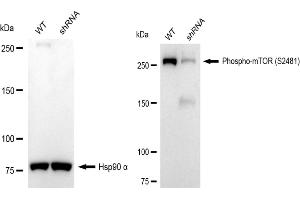 Western blotting analysis using Phospho-mTOR (S) antibody (ABIN7799349). (Rekombinanter MTOR Antikörper  (pSer2481))