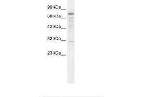 Image no. 1 for anti-tRNA Methyltransferase 1 (TRMT1) (AA 418-467) antibody (ABIN202857) (TRMT1 Antikörper  (AA 418-467))