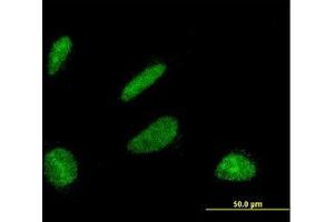 Image no. 2 for anti-DBF4 Homolog (DBF4) (AA 2-99) antibody (ABIN599157) (DBF4 Antikörper  (AA 2-99))