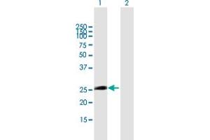 Western Blot analysis of ITGB1BP3 expression in transfected 293T cell line by ITGB1BP3 MaxPab polyclonal antibody. (ITGB1BP3 Antikörper  (AA 1-230))