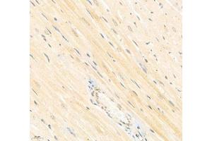 Immunohistochemistry of paraffin embedded rat heart using Arhgap17 (ABIN7075416) at dilution of 1: 700 (400x lens) (ARHGAP17 Antikörper)